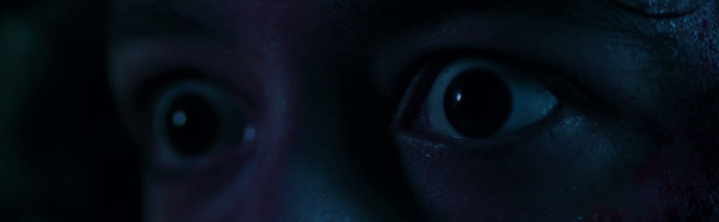 <h1>Urticária Incandescente</h1><strong>SP, 19 MIN</strong>